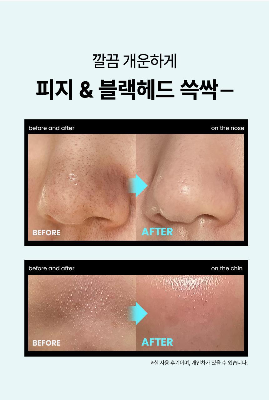 ILSO Super Melting Sebum Softener